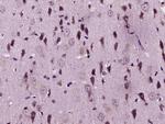 MMP-1 Antibody in Immunohistochemistry (Paraffin) (IHC (P))