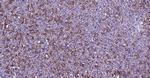 MMP-1 Antibody in Immunohistochemistry (Paraffin) (IHC (P))