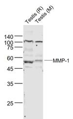 MMP-1 Antibody in Western Blot (WB)