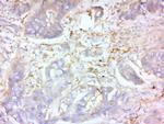 MMP-2 Antibody in Immunohistochemistry (Paraffin) (IHC (P))