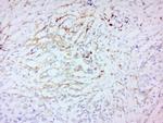 MMP-2 Antibody in Immunohistochemistry (Paraffin) (IHC (P))