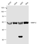 MMP-2 Antibody in Western Blot (WB)