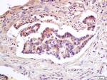 TIMP-1 Antibody in Immunohistochemistry (Paraffin) (IHC (P))