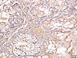 TIMP-1 Antibody in Immunohistochemistry (Paraffin) (IHC (P))