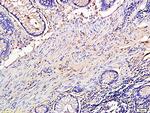 TIMP-1 Antibody in Immunohistochemistry (Paraffin) (IHC (P))