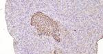 TIMP-1 Antibody in Immunohistochemistry (Paraffin) (IHC (P))