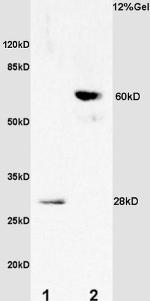 TIMP-1 Antibody in Western Blot (WB)