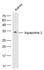 AQP2 Antibody in Western Blot (WB)