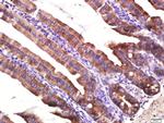 Layilin Antibody in Immunohistochemistry (Paraffin) (IHC (P))