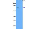 Galactocerebtosidase Antibody in Western Blot (WB)