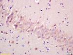 Phospho-GSK3 Alpha (Ser21) Antibody in Immunohistochemistry (Paraffin) (IHC (P))