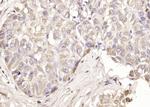 AFP Antibody in Immunohistochemistry (Paraffin) (IHC (P))