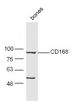 CD168 Antibody in Western Blot (WB)