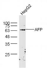 AFP Antibody in Western Blot (WB)