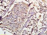 IKK alpha/beta Antibody in Immunohistochemistry (Paraffin) (IHC (P))