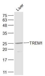 TREM1 Antibody in Western Blot (WB)