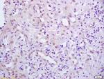 Phospho-PPAR Gamma (Ser273) Antibody in Immunohistochemistry (Paraffin) (IHC (P))