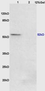 Phospho-PPAR Gamma (Ser273) Antibody in Western Blot (WB)