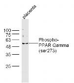 Phospho-PPAR Gamma (Ser273) Antibody in Western Blot (WB)