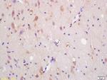 CXCR7/RDC1 Antibody in Immunohistochemistry (Paraffin) (IHC (P))