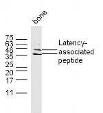 TGFB1 Antibody in Western Blot (WB)