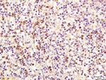 MCSF Antibody in Immunohistochemistry (Paraffin) (IHC (P))