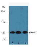 ENPP1 Antibody in Western Blot (WB)