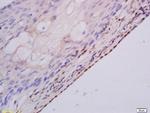 MSH3 Antibody in Immunohistochemistry (Paraffin) (IHC (P))