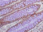 IL-1 Alpha Antibody in Immunohistochemistry (Paraffin) (IHC (P))