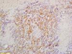 CRTAM Antibody in Immunohistochemistry (Paraffin) (IHC (P))