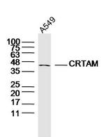 CRTAM Antibody in Western Blot (WB)