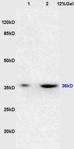 DcR2 Antibody in Western Blot (WB)