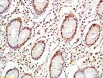 C-Myc Antibody in Immunohistochemistry (Paraffin) (IHC (P))