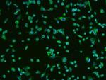 BDNF Antibody in Immunocytochemistry (ICC/IF)