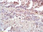 Insulin receptor subunit beta Antibody in Immunohistochemistry (Paraffin) (IHC (P))