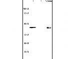 PHKG2 Antibody in Western Blot (WB)