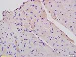 CPT1B Antibody in Immunohistochemistry (Paraffin) (IHC (P))