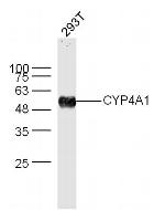 Cytochrome P450 4A Antibody in Western Blot (WB)