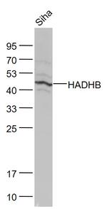 HADHB Antibody in Western Blot (WB)