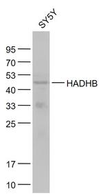 HADHB Antibody in Western Blot (WB)