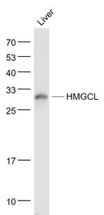 HMGCL Antibody in Western Blot (WB)