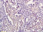 PHYH Antibody in Immunohistochemistry (Paraffin) (IHC (P))