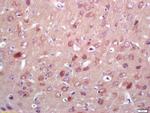 PNPO Antibody in Immunohistochemistry (Paraffin) (IHC (P))