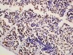 HCLS1 Antibody in Immunohistochemistry (Paraffin) (IHC (P))