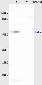 HCLS1 Antibody in Western Blot (WB)