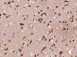 Phospho-APBB1 (Ser175) Antibody in Immunohistochemistry (Paraffin) (IHC (P))