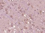 Phospho-GADD153 (Ser30) Antibody in Immunohistochemistry (Paraffin) (IHC (P))