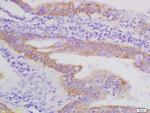 AXL Antibody in Immunohistochemistry (Paraffin) (IHC (P))