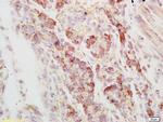 AXL Antibody in Immunohistochemistry (Paraffin) (IHC (P))