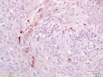 Phospho-AXL (Tyr698, Tyr702, Tyr703) Antibody in Immunohistochemistry (Paraffin) (IHC (P))